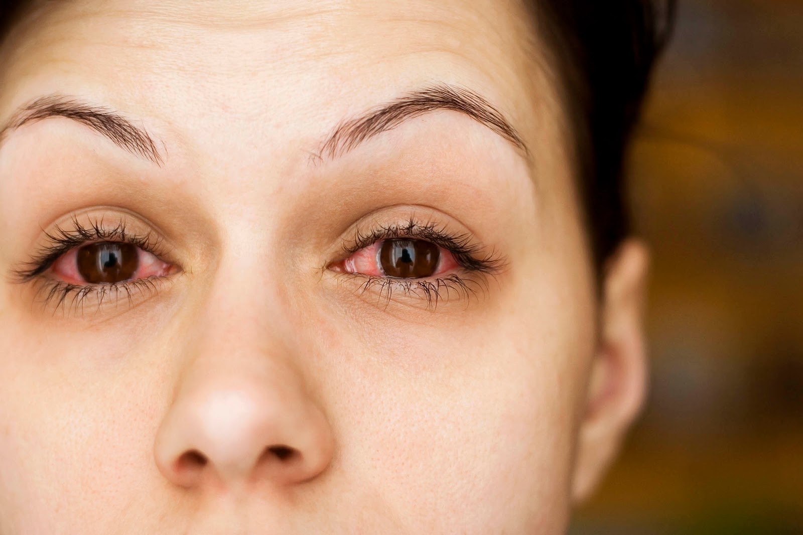 Nguyên nhân gây ra đau mắt đỏ là gì?
