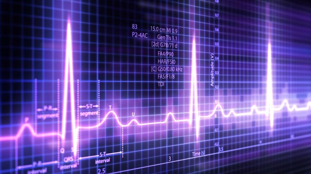 Tìm hiểu về kết quả điện tim bình thường như thế nào?