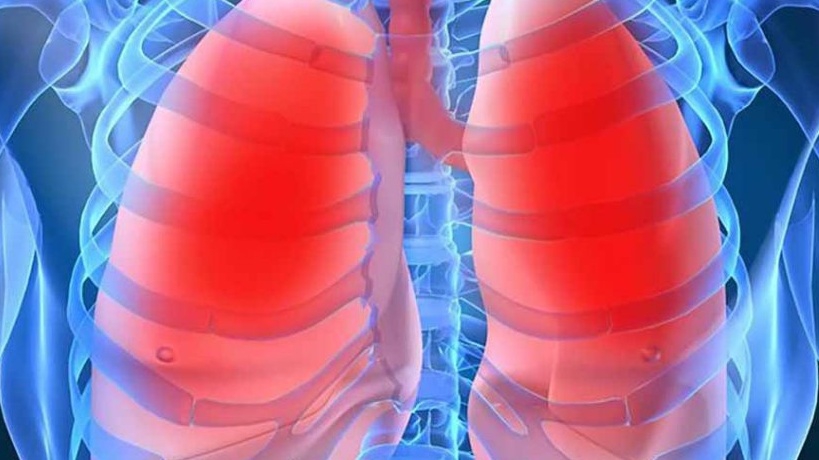 Cách tăng cường hệ miễn dịch để hỗ trợ điều trị bệnh lao phổi tại nhà?
