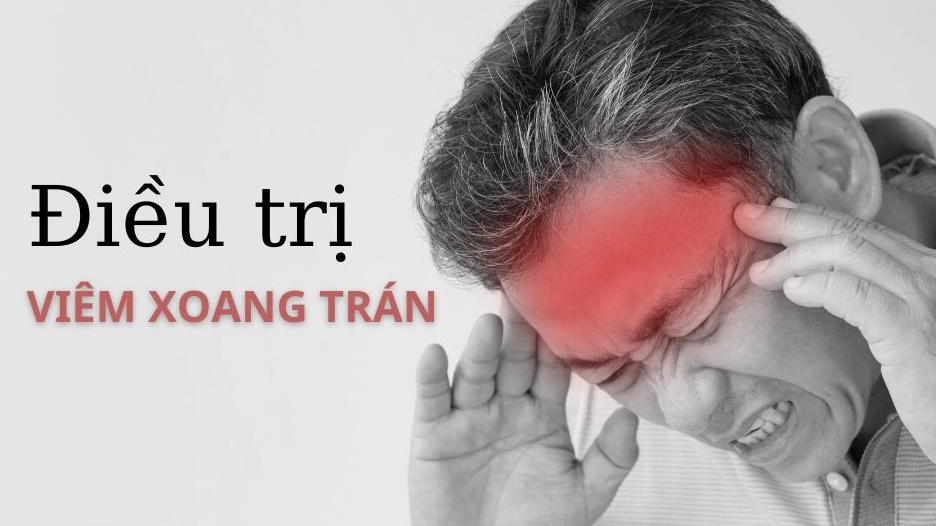 Cách điều trị viêm xoang trán phổ biến hiện nay