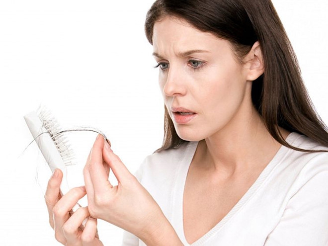 Đối phó với bệnh bướu cổ rụng tóc chỉ bằng những mẹo đơn giản