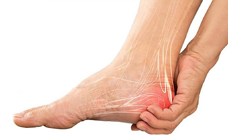 Đứt gân gót chân: Nguyên nhân, dấu hiệu và cách điều trị 1