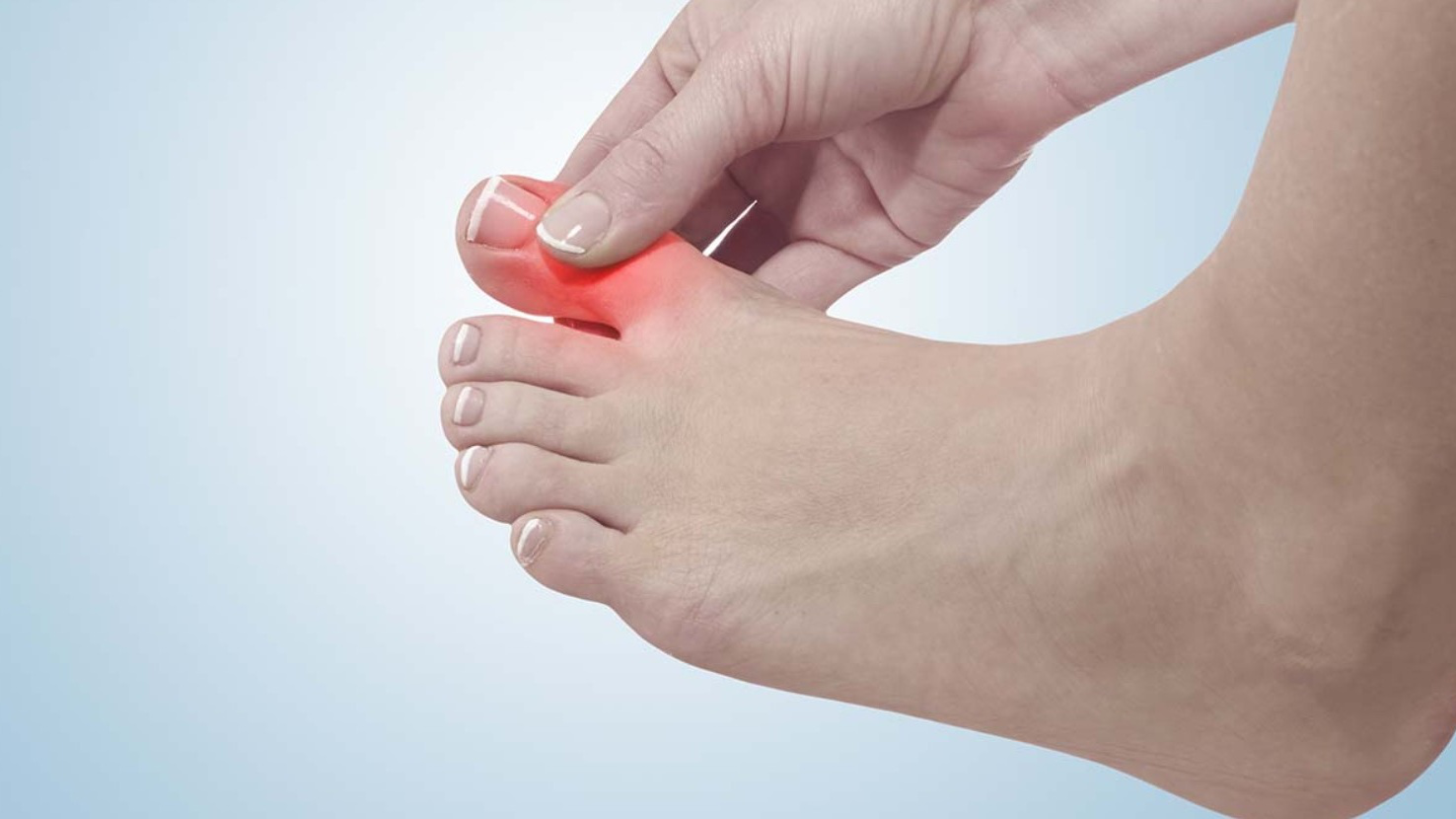 Đứt gân ngón chân có nguy hiểm không?