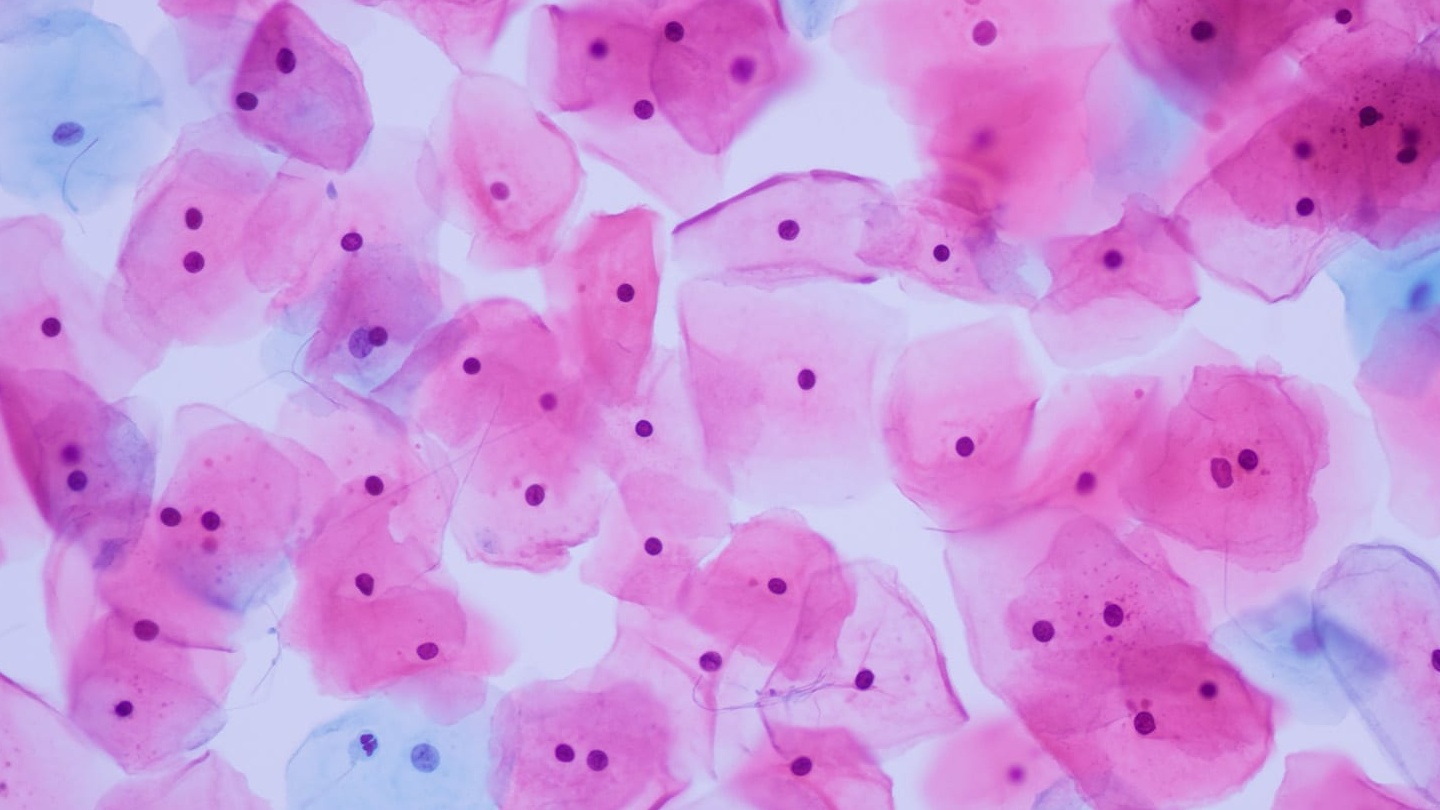 Epithelial cells là gì trong xét nghiệm nước tiểu?