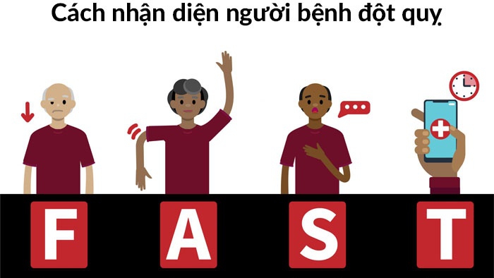 FAST đột quỵ: Dấu hiệu nhận biết sớm đột quỵ và cách xử lý 1