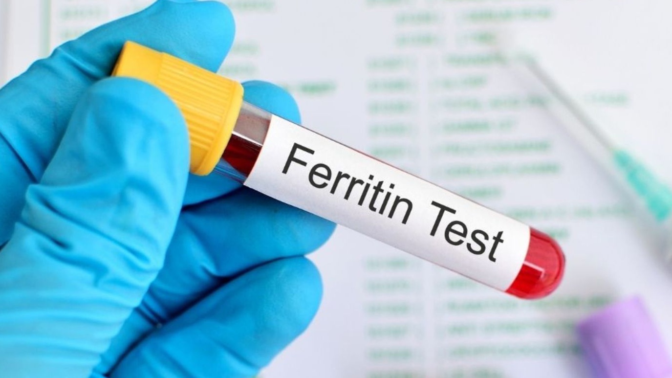 Ferritin tăng là tình trạng gì? Cần làm gì khi Ferritin tăng?