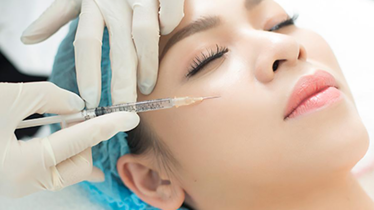 Filler Dermalax: Giải pháp xóa mờ nếp nhăn