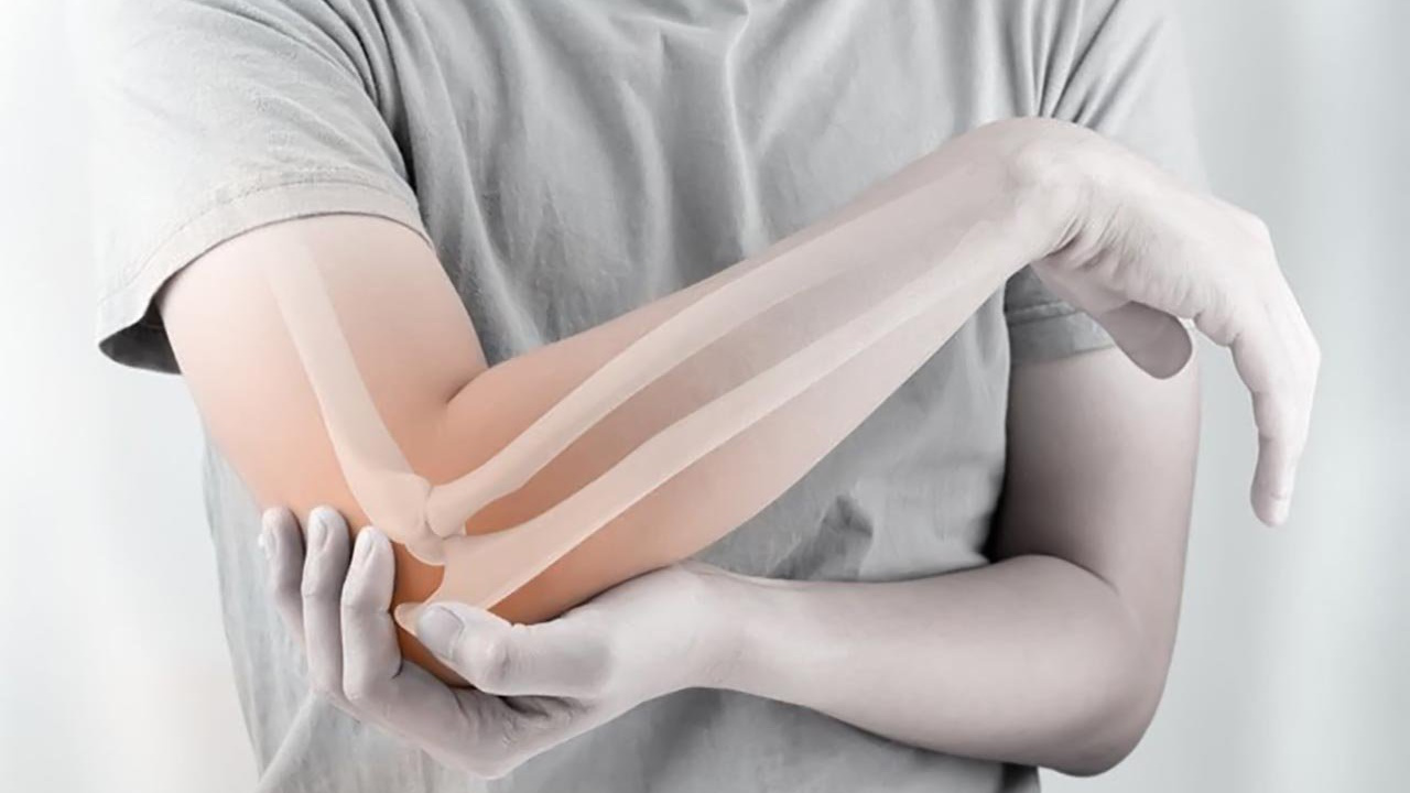 Quá trình chẩn đoán gãy lồi cầu ngoài xương cánh tay như thế nào?
