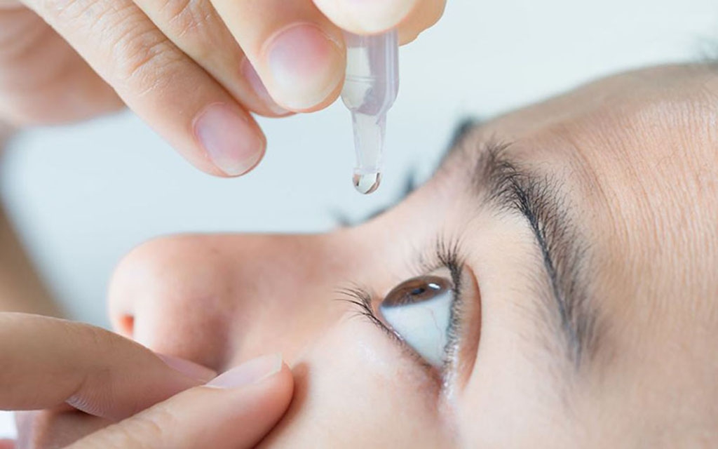 Có nên nhỏ nước muối khi bị đau mắt do tiếp xúc với tia hàn không?