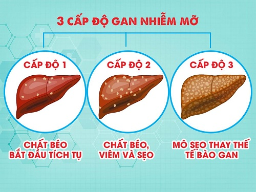 Giải đáp thắc mắc: Bị bệnh gan nhiễm mỡ độ 3 sống được bao lâu? 1