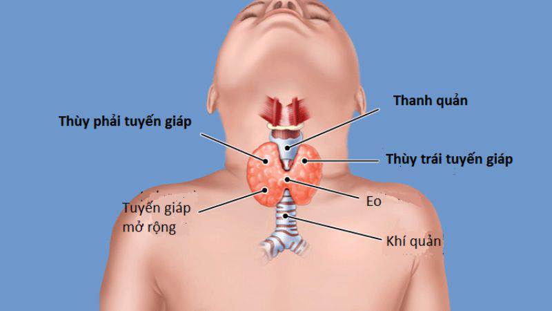 Giải đáp thắc mắc: Cường giáp có gây ung thư không? 1