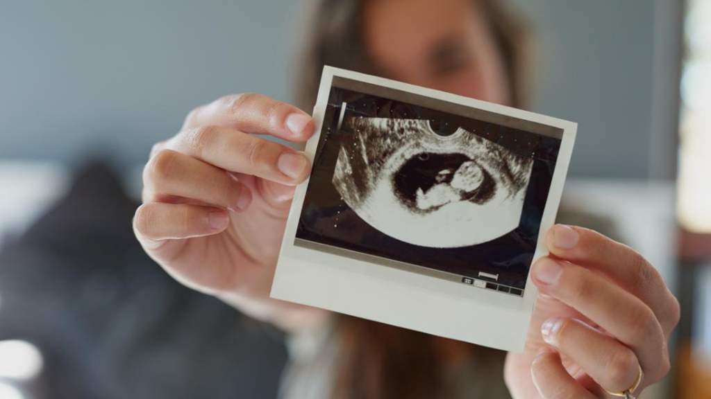 Cách bác sĩ sử dụng siêu âm để xác định giới tính của thai nhi ở tuần thứ 12?
