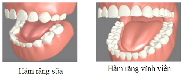Làm cách nào để nhận biết rằng một răng là răng sữa chưa rụng hay răng vĩnh viễn?
