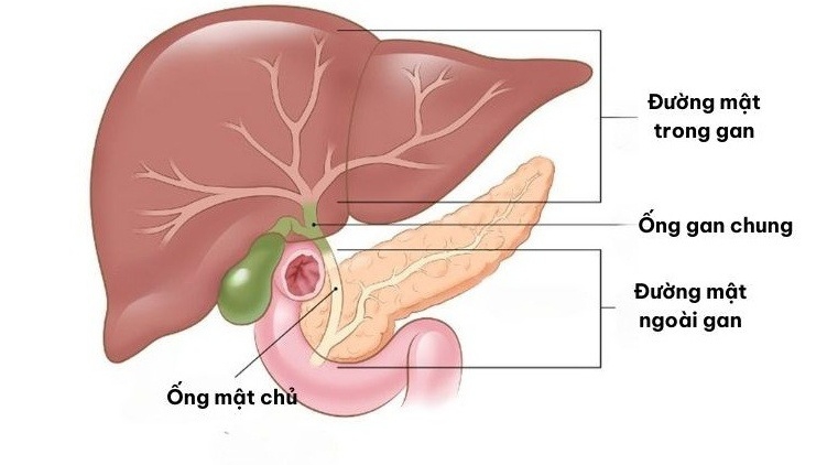 Giãn đường mật trong gan: Nguyên nhân, chẩn đoán và điều trị bệnh 1