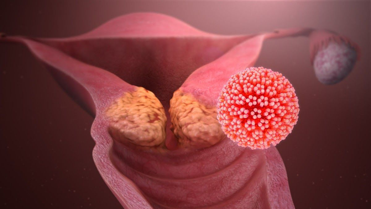 Lây lan HPV 12 type nguy cơ cao qua đường nào?
