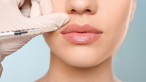 Những chất gây kích thích nào cần tránh sau khi tiêm filler môi?
