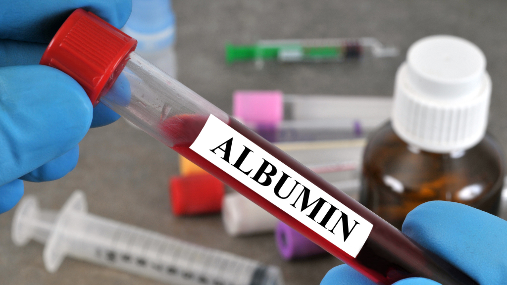 Hạ albumin máu: Triệu chứng, biến chứng và phương pháp điều trị