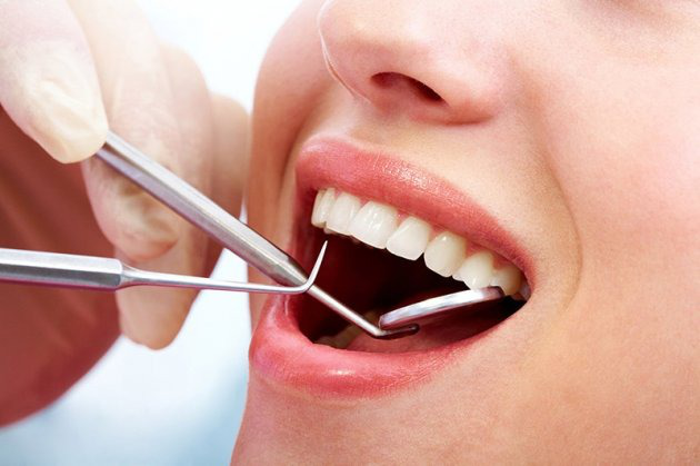 Hàm khung liên kết là gì? Hàm khung liên kết chia thành mấy loại? 4