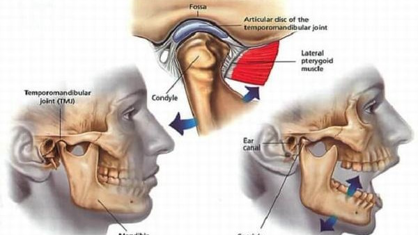 Hiểu rõ về hiện tượng sái quai hàm