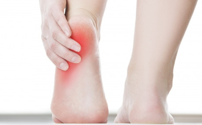 Cách chữa trị đau gót chân khi đá bóng hiệu quả tại nhà