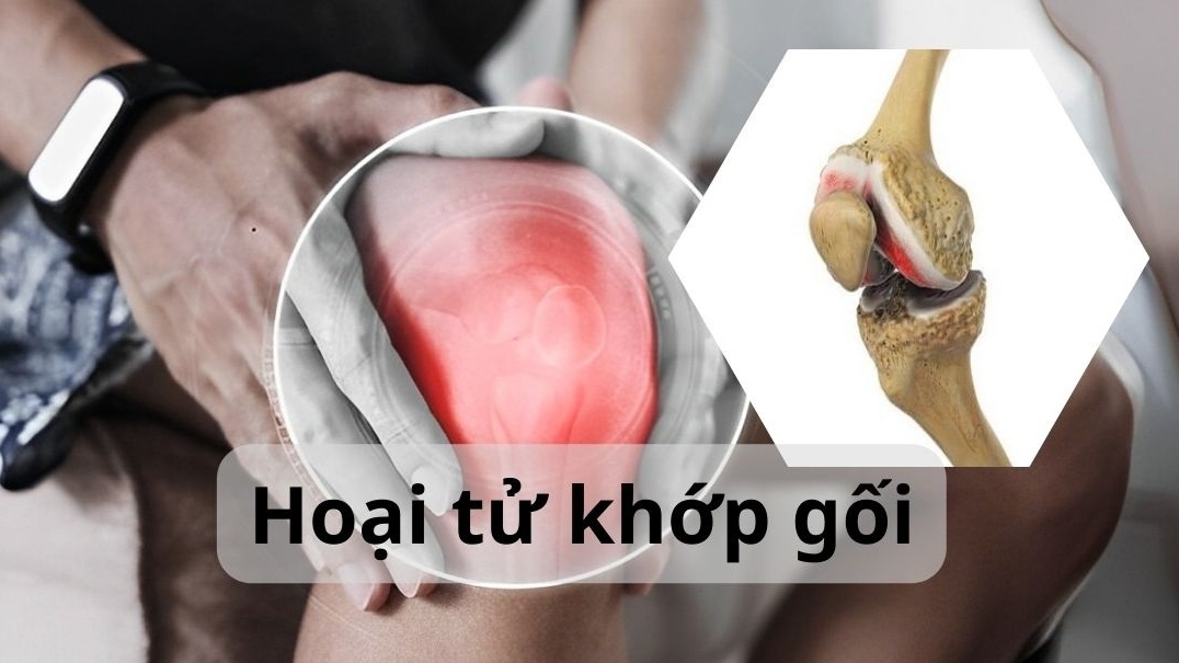 Hoại tử khớp gối có nguy hiểm không?