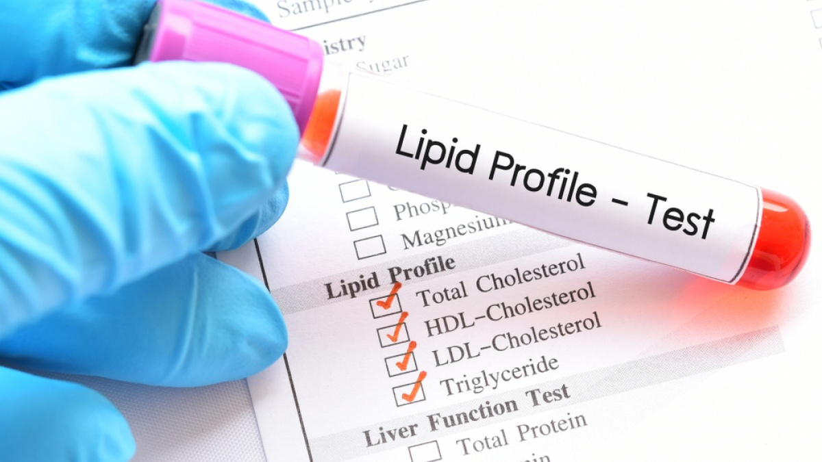 Tại sao mỡ máu xấu LDL là chỉ số cần được quan tâm?
