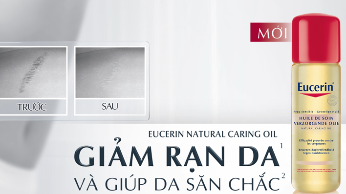 Kem trị rạn da Eucerin có tốt không?