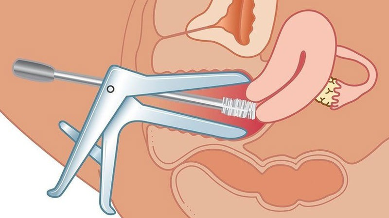 Khám Phụ Khoa Mỏ Vịt: Hướng Dẫn Toàn Diện và Lợi Ích Đáng Kể