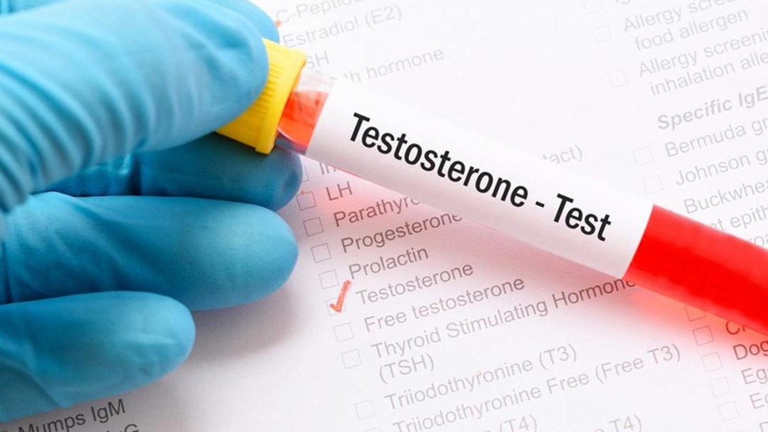 Khi nào cần thực hiện xét nghiệm testosterone?