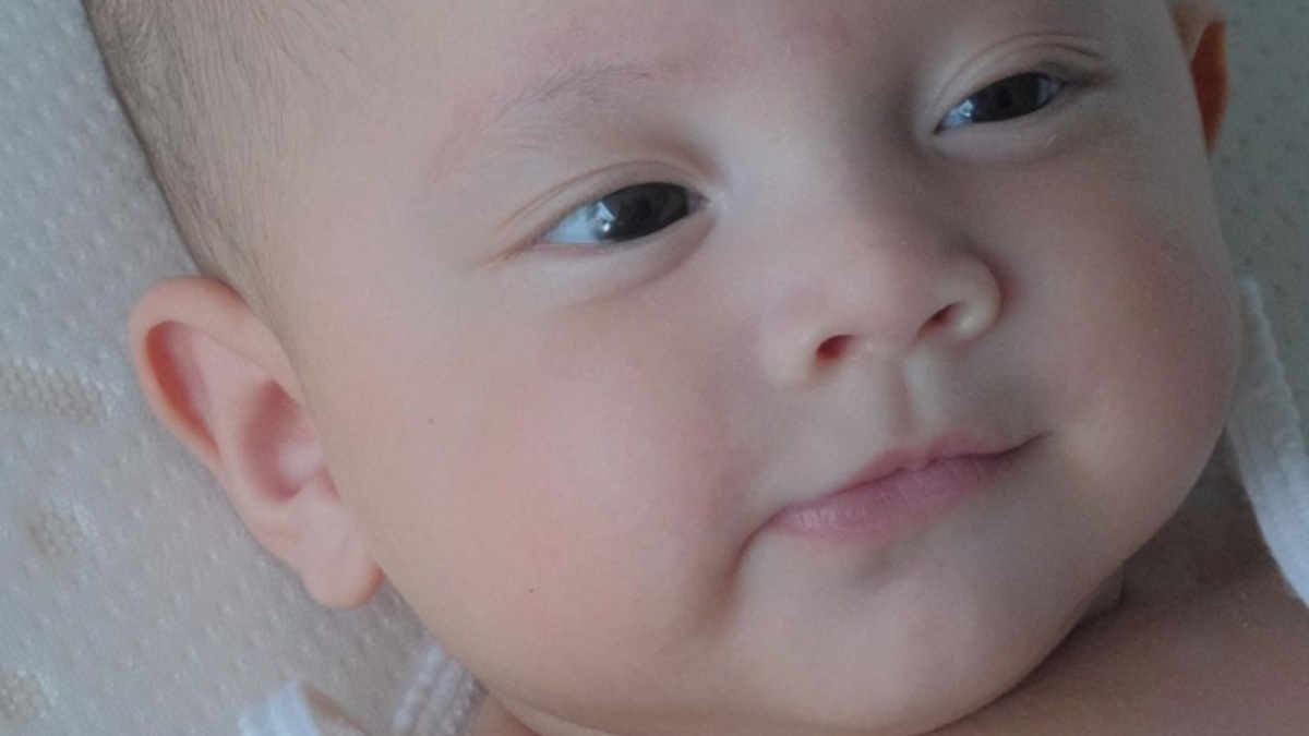 Mắt một mí ở em bé có phải là do gene di truyền từ cha mẹ?