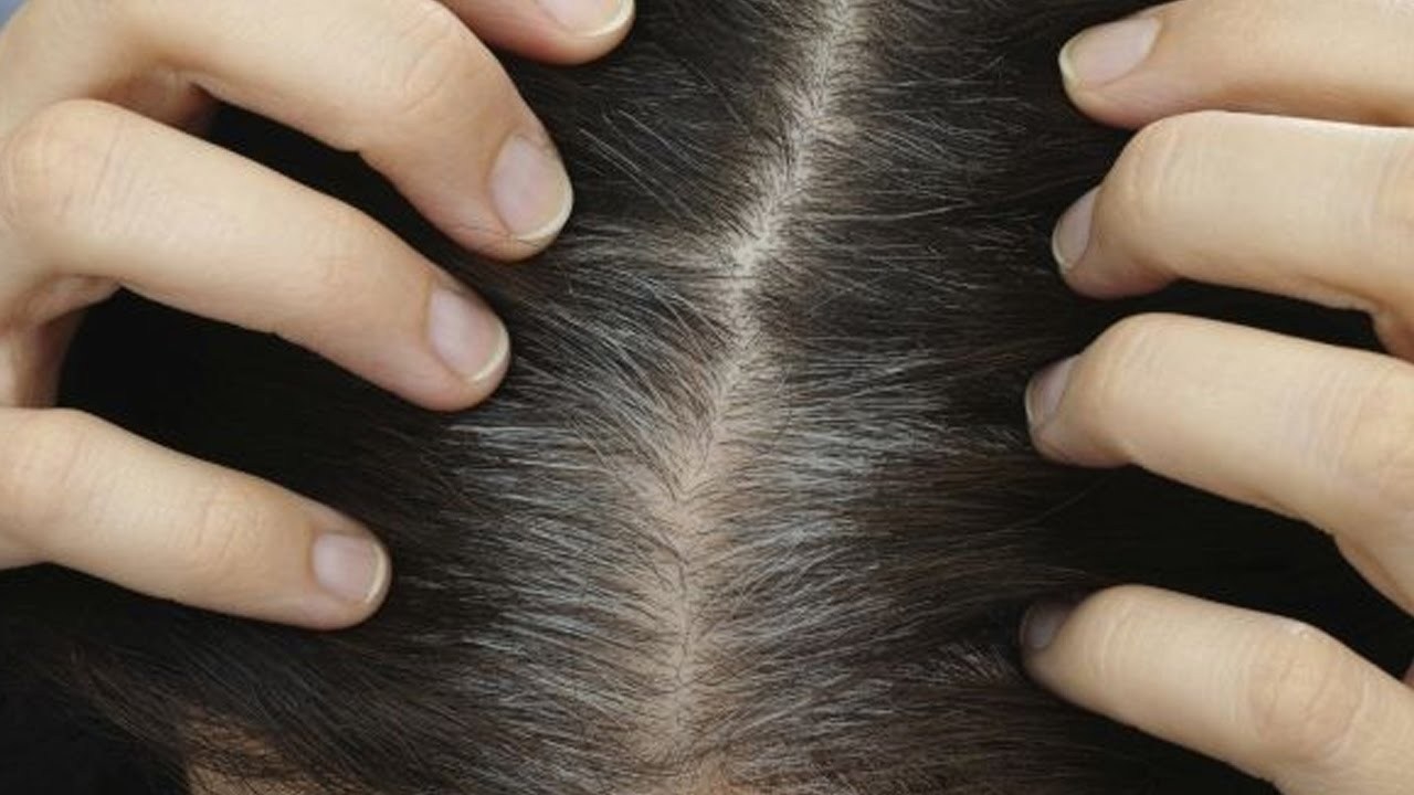 6 nguyên nhân gây bạc tóc sớm ở nam giới – Weilaiya Việt Nam