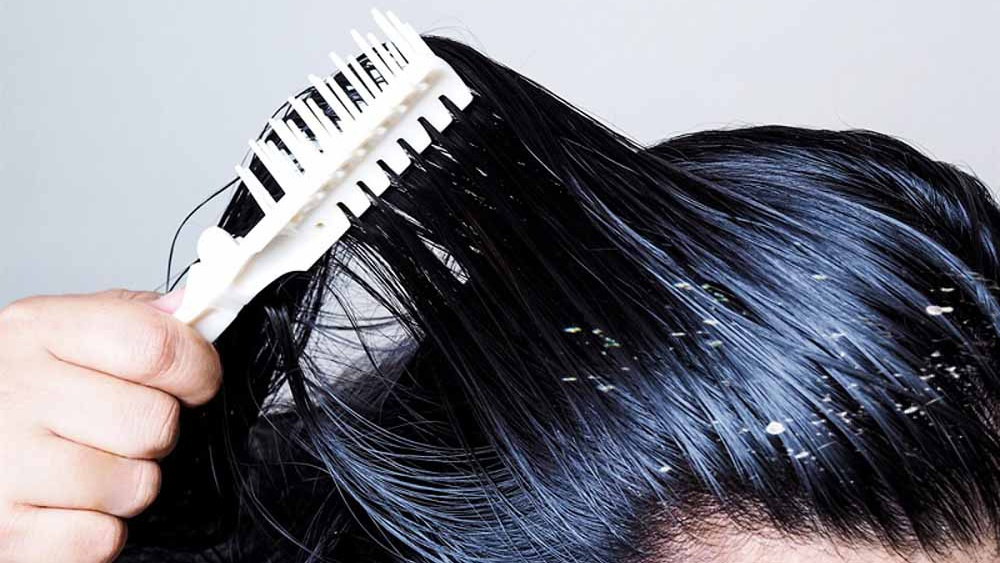 Nguyên nhân gây ra mái tóc bết dầu? Cách trị bết tóc hiệu quả tại nhà