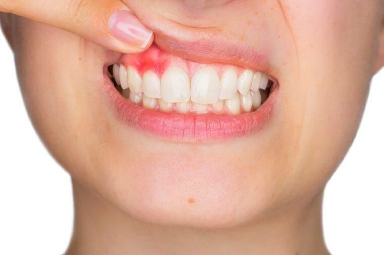 Làm thế nào để bổ sung vitamin C đúng cách và hiệu quả?