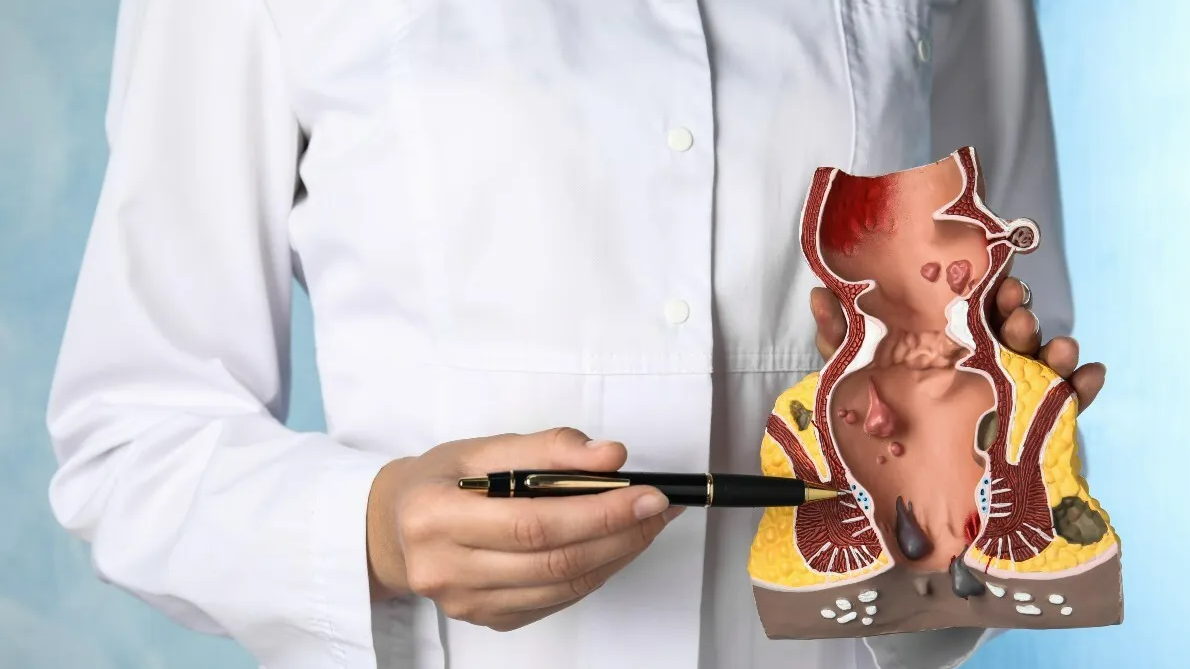 Liệu nằm nhiều có bị trĩ không? Người mắc bệnh trĩ nên nằm như thế nào?