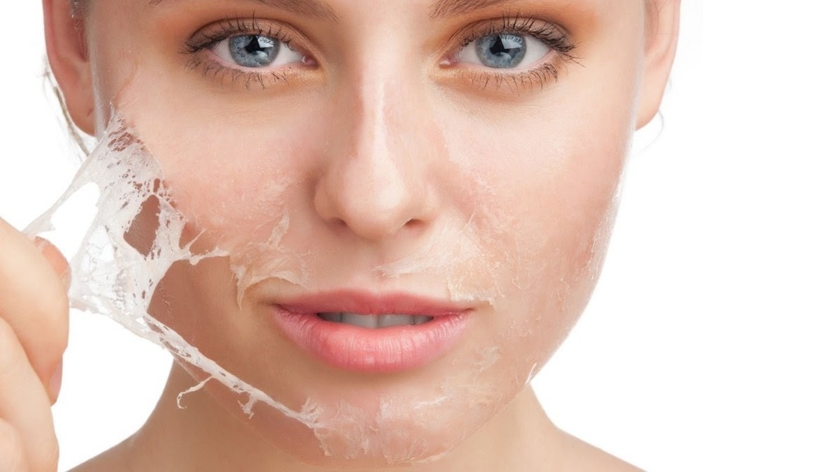 [Giải đáp] Lột mụn xong tẩy tế bào chết được không?