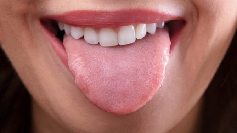 Lưỡi bình thường và các bệnh lý về lưỡi thường gặp 1