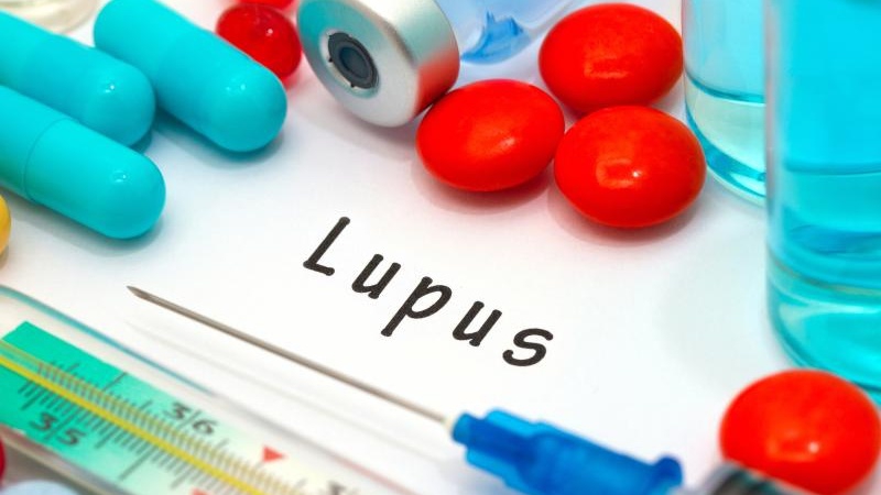 Chăm sóc sức khỏe cho bệnh nhân bệnh lupus ban đỏ giai đoạn cuối hiệu quả