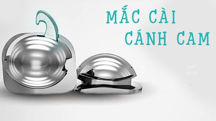 Mắc cài cánh cam: Giải pháp niềng răng thẩm mỹ và những ưu nhược điểm cần biết 2