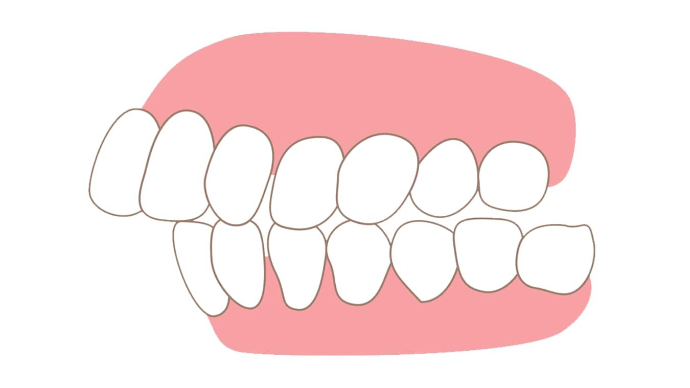 Điều gì làm răng đều đẹp và chắc khỏe?
