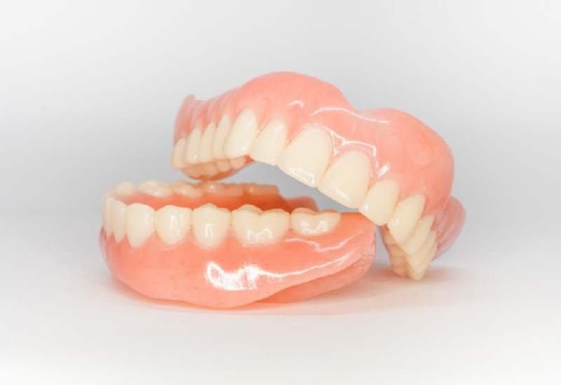 Mầm răng là gì? Thiếu mầm răng vĩnh viễn phải làm sao? 2