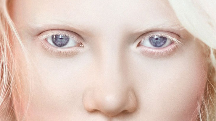 Màu mắt có do di truyền không? 3