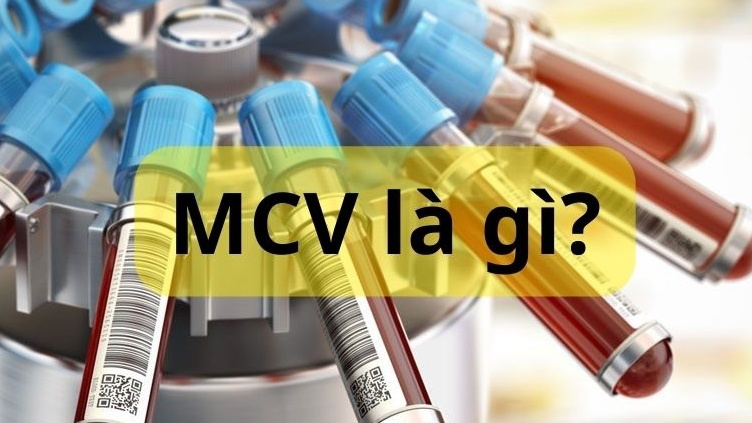 Có những nguyên nhân nào có thể dẫn đến thay đổi trong chỉ số MCV?