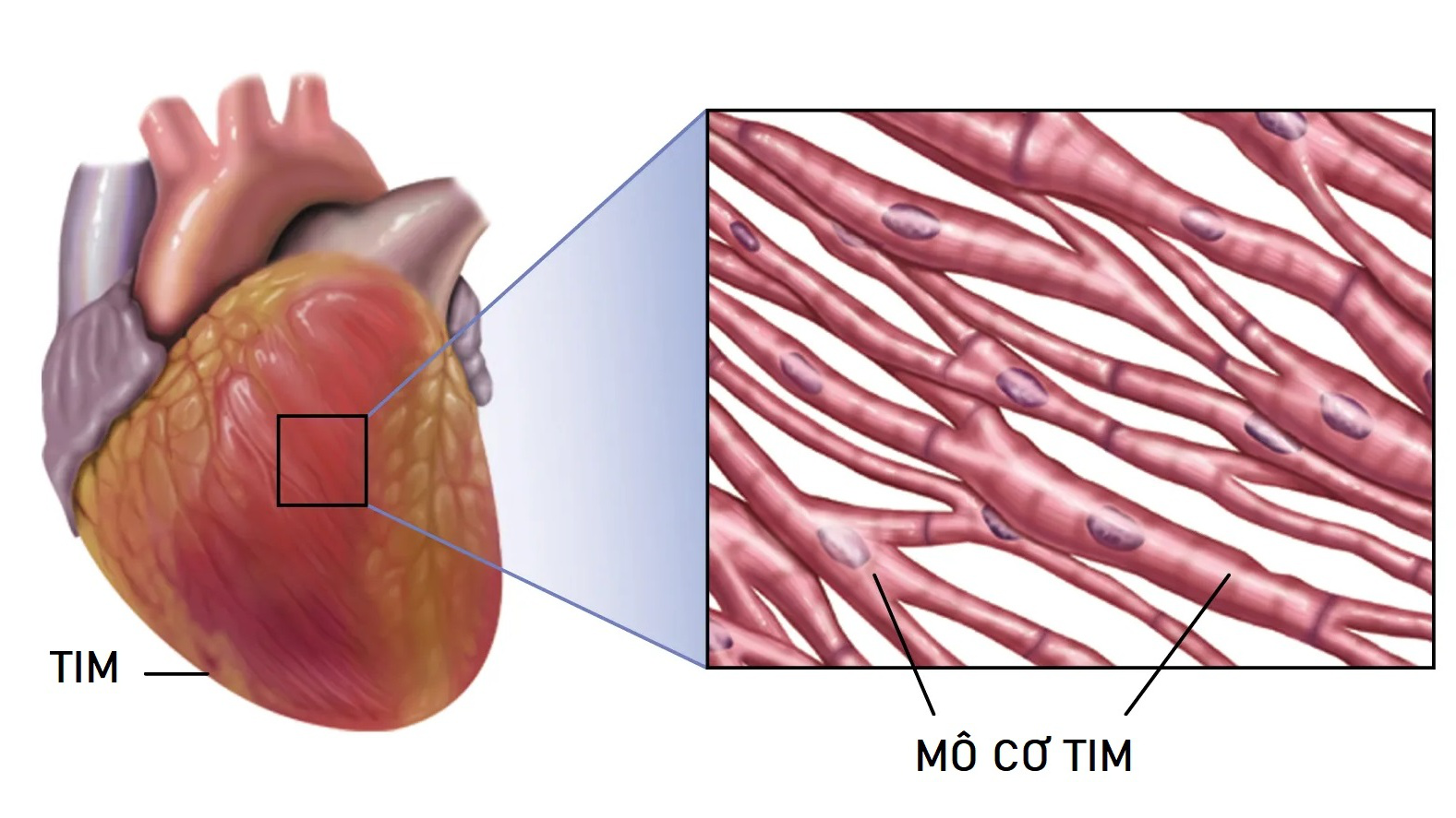 Mô cơ tim là gì? Các bệnh thường gặp ở mô cơ tim