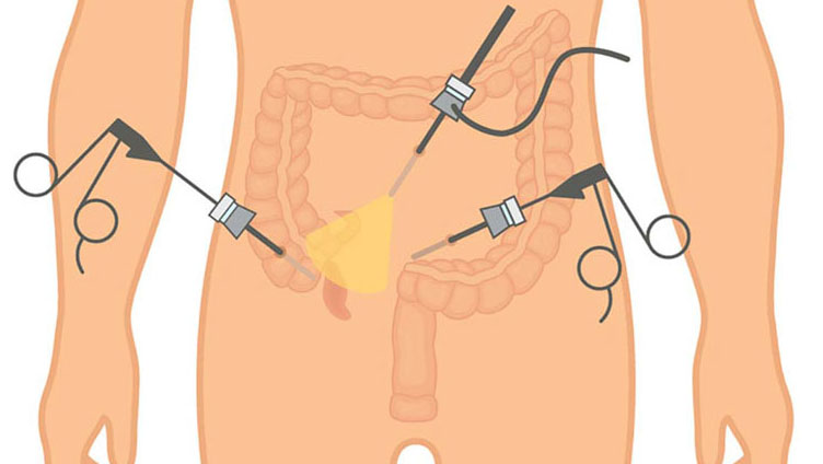 Hướng Dẫn Chăm Sóc Sau Mổ