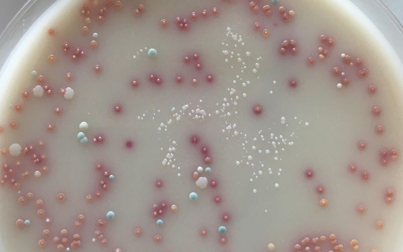 Tụ cầu khuẩn là nguyên nhân phổ biến nhất gây lẹo mắt