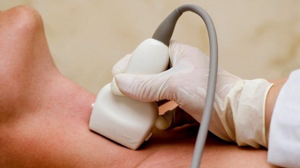 Mục đích và quy trình của siêu âm tuyến giáp