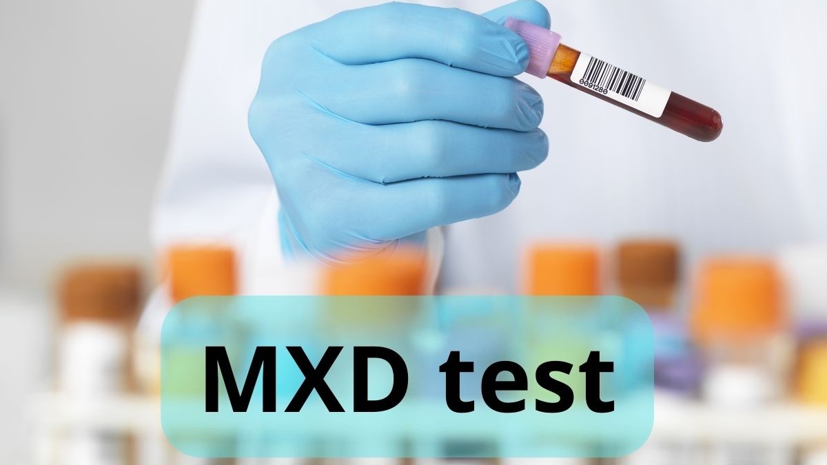 MXD trong xét nghiệm máu là gì?