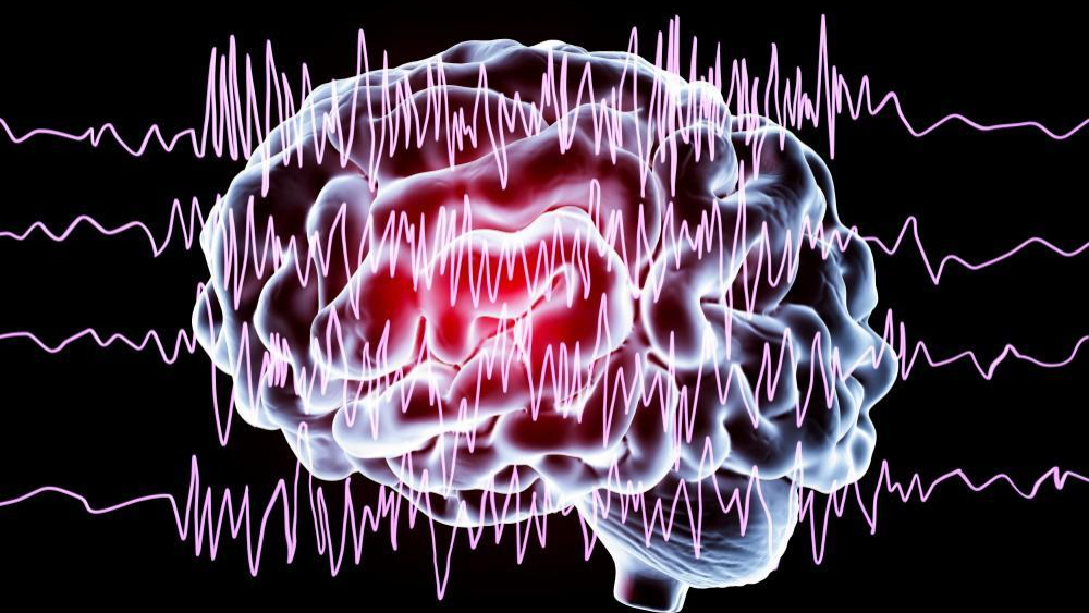 Myoclonus: Một dạng động kinh phổ biến ở trẻ em