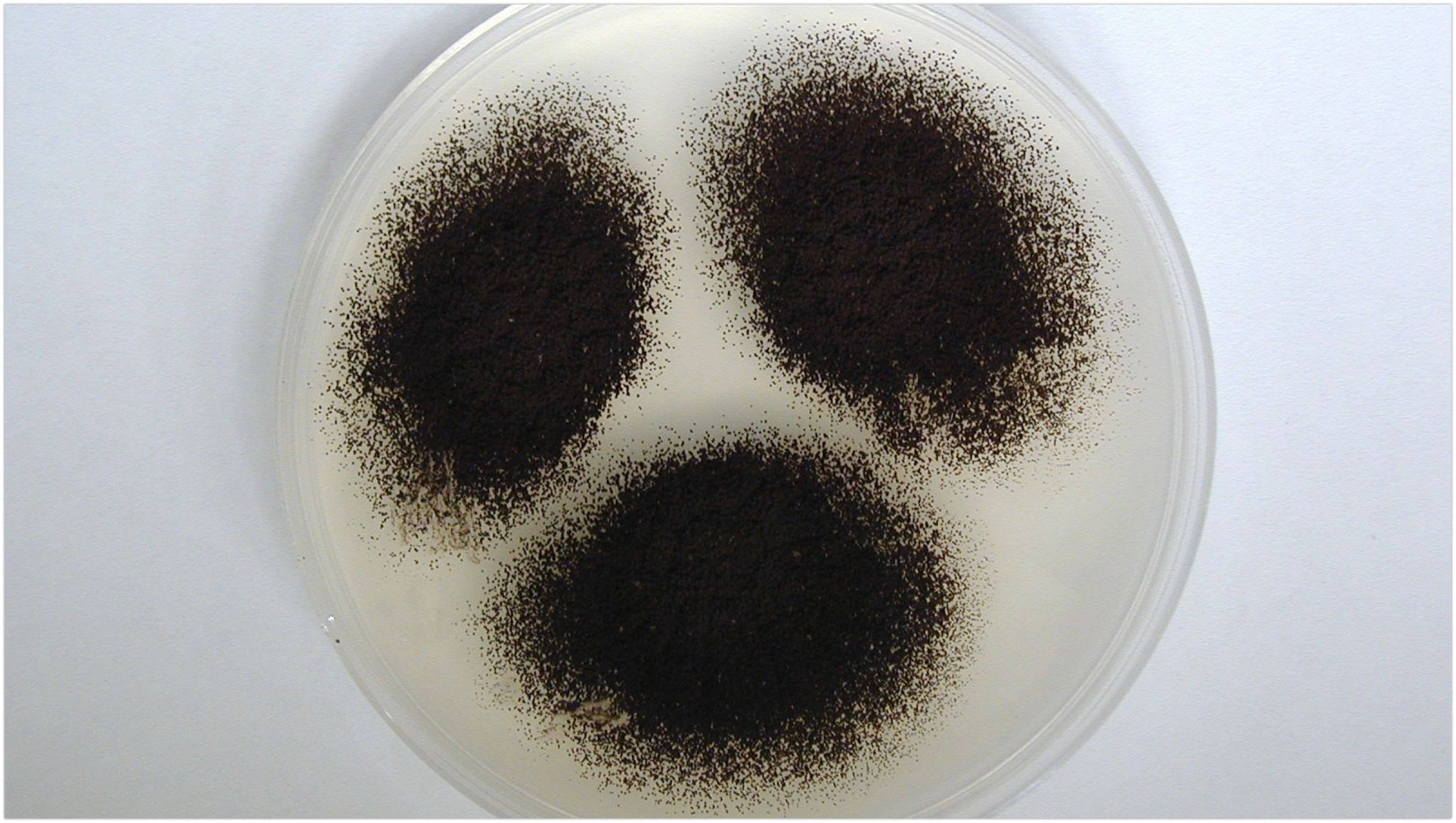 Nấm mốc Aspergillus niger là gì? Một số bệnh lý do Aspergillus niger gây ra