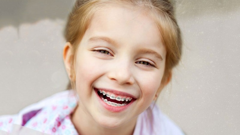 Phương pháp nắn chỉnh răng cho trẻ em có thể bạn chưa biết 2